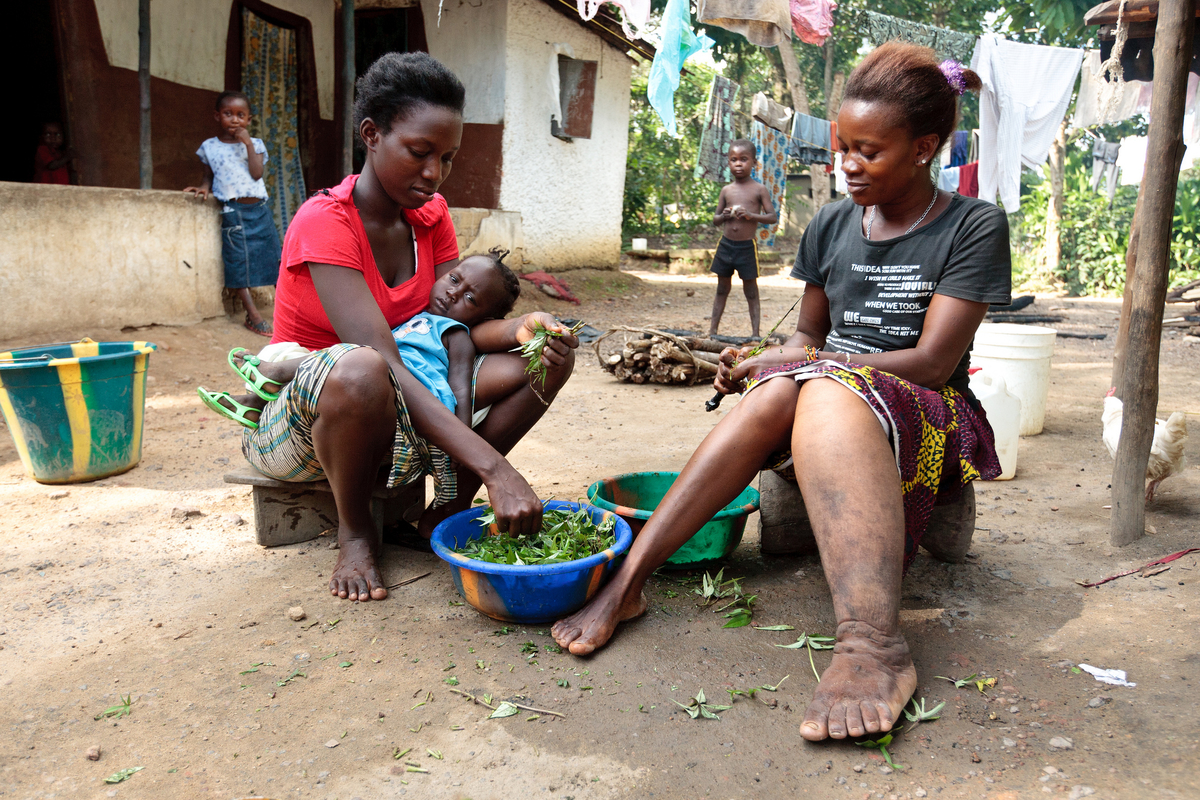 Lymphatic Filariasis/Elephantiasis Patient