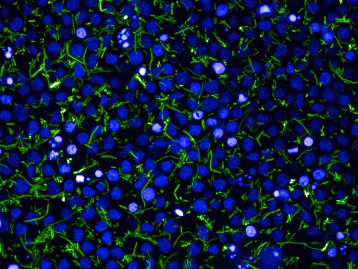 High-Content Imaging of extracellular and intracellular Salmonella Typhi (Ty21a)_GFP High-Content Imaging of extracellular and intracellular Salmonella Typhi (Ty21a)_GFP