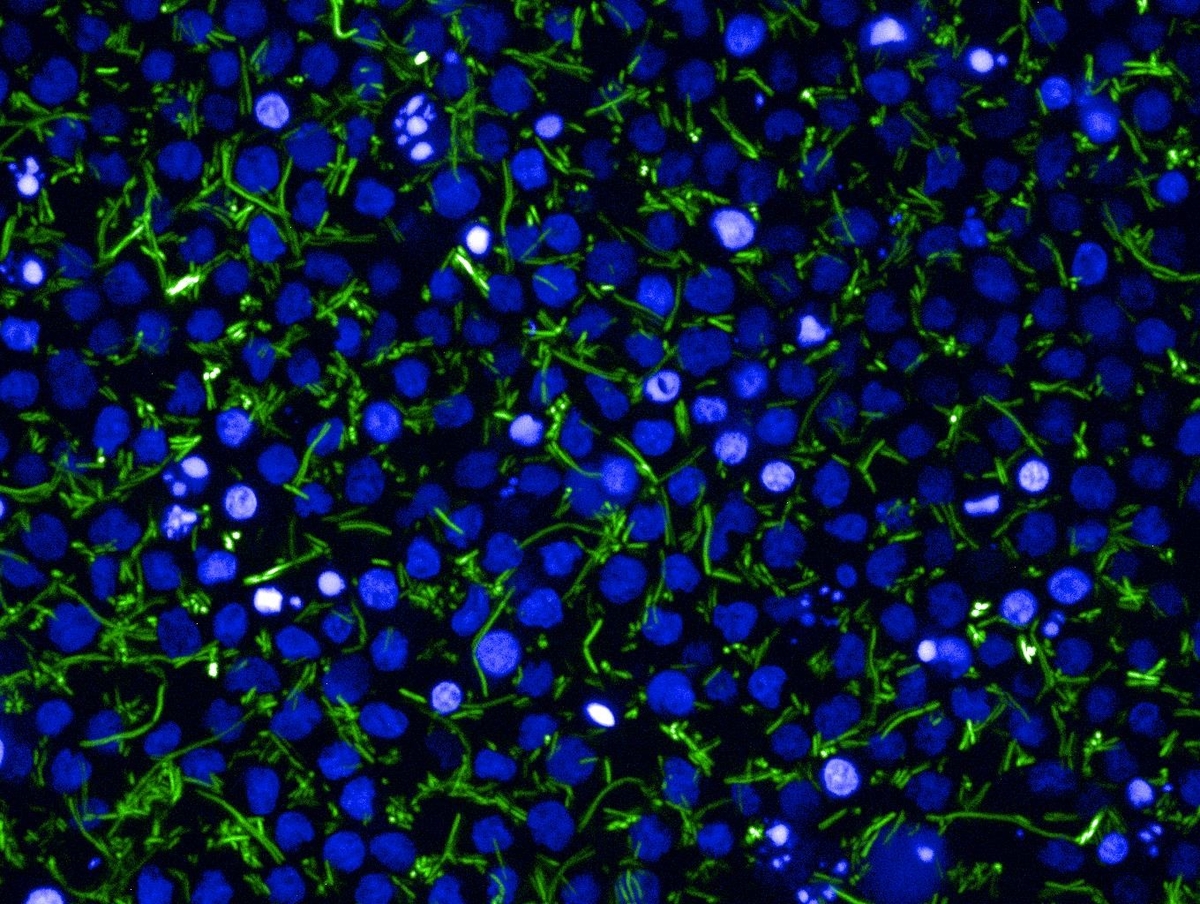 High-Content Imaging  of extracellular and intracellular Salmonella Typhi (Ty21a)_GFP