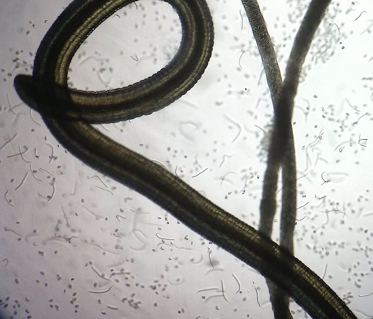 Microscopic photo of eye worm loa loa