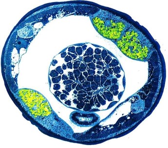 Wolbachia (green) within O. volvulus