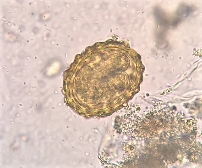   “Someday, when I grow up…” Ascaris egg in faecal smear.