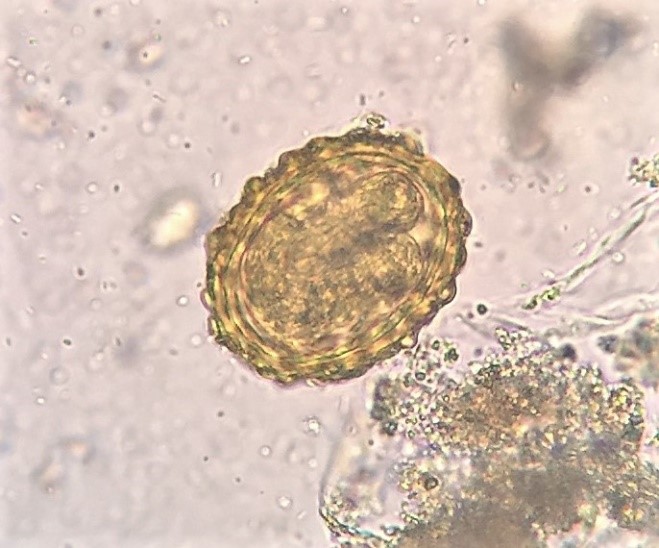 “Someday, when I grow up…” Ascaris egg in faecal smear. “Someday, when I grow up…” Ascaris egg in faecal smear.