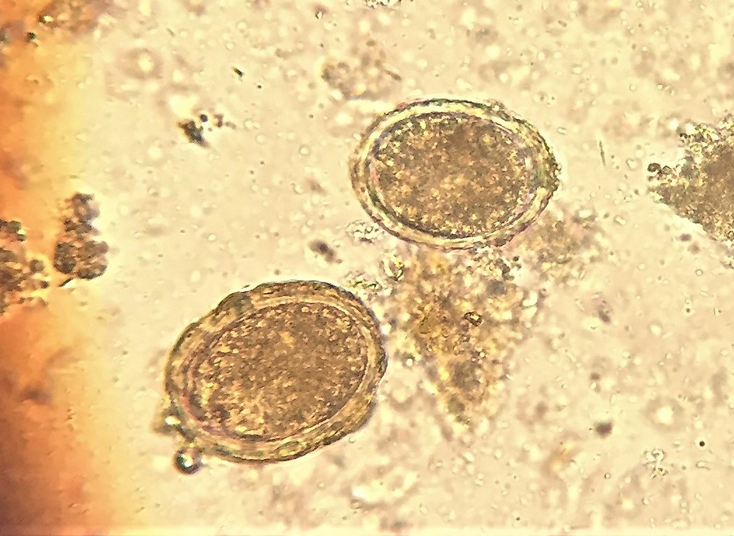 Creepy tropical eggs (under x400 magnification).