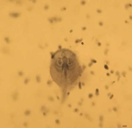 Giardia parasite caught by surprise under high magnification of faecal sample.