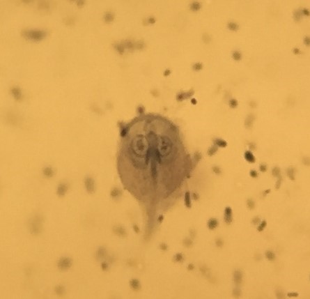 Giardia parasite caught by surprise under high magnification of faecal sample. Giardia parasite caught by surprise under high magnification of faecal sample.