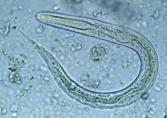 L1 larvae stage (from lecture notes)