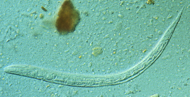 Strongyloides stercoralis larva