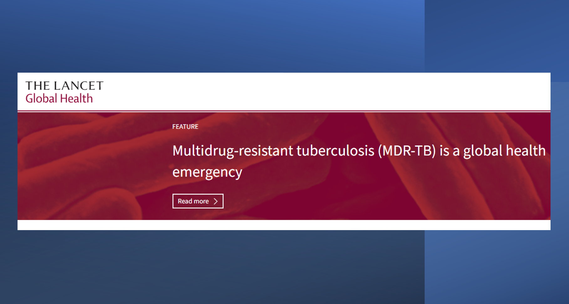 Multidrugresistant tuberculosis (MDRTB) is a global health emergency