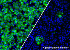 Human cells normally infected with SARS-CoV-2, here shown in green (left). Upon treatment with a sub-inhibitory dose of a glycosylation inhibitor, the infection is greatly reduced (right)