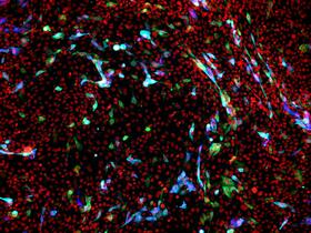 Infected lung epithelial cells