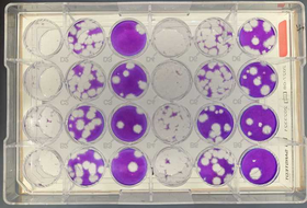 Plaque assays which are done to quantify virus infectivity