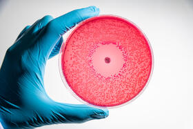 microbiological culture being examined