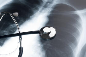 Image of a chest x ray