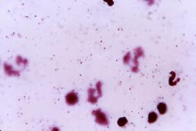 plasmodium falciparum 