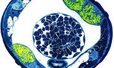 Cross section filarial nematode wolbachia in green