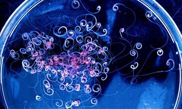 Image of Ecuadorian whipworms (image: Mark Taylor)