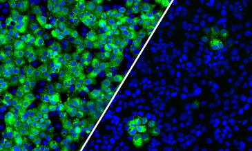 Human cells normally infected with SARS-CoV-2, here shown in green (left). Upon treatment with a sub-inhibitory dose of a glycosylation inhibitor, the infection is greatly reduced (right)