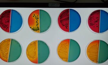 E.coli samples