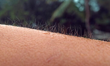 A close up of skin (credit: helivideo)