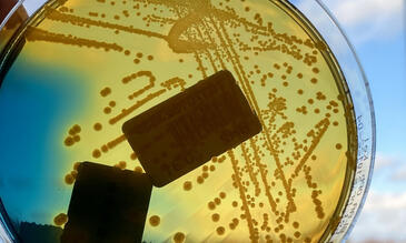 E.coli grown on an agar plate held against the sky