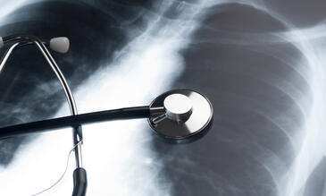 Image of a chest x ray