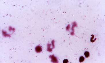 plasmodium falciparum 