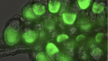 Drosophila melanogaster Yolk protein-GFP fusion in Anopheles ovaries - Grant Hughes