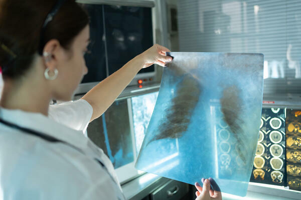 Woman radiology doctor examining chest x-ray film of patient in health care Woman radiology doctor examining chest x-ray film of patient in health care