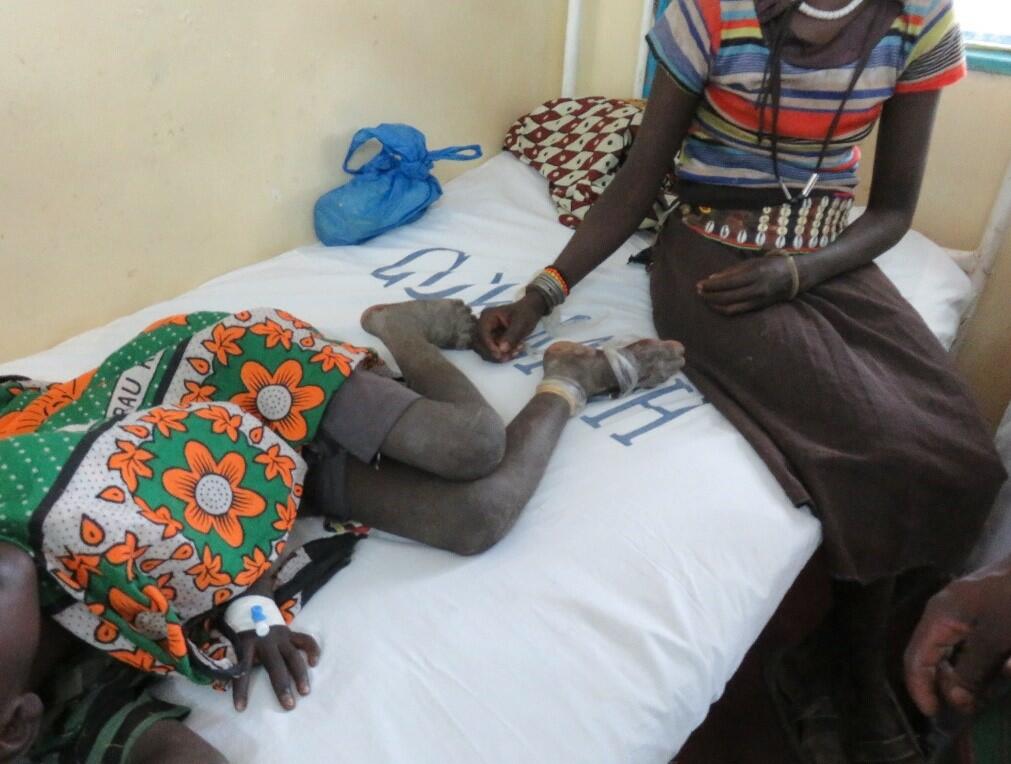 It took this mother 14 hours to get her child, who was bitten by a snake, to hospital in Baringo, Kenya to receive antivenom. The amount of time required for a snakebite victim to reach a medical centre to receive treatment remains a major issue in rural African communities. Photo taken by Prof. Rob Harrison.