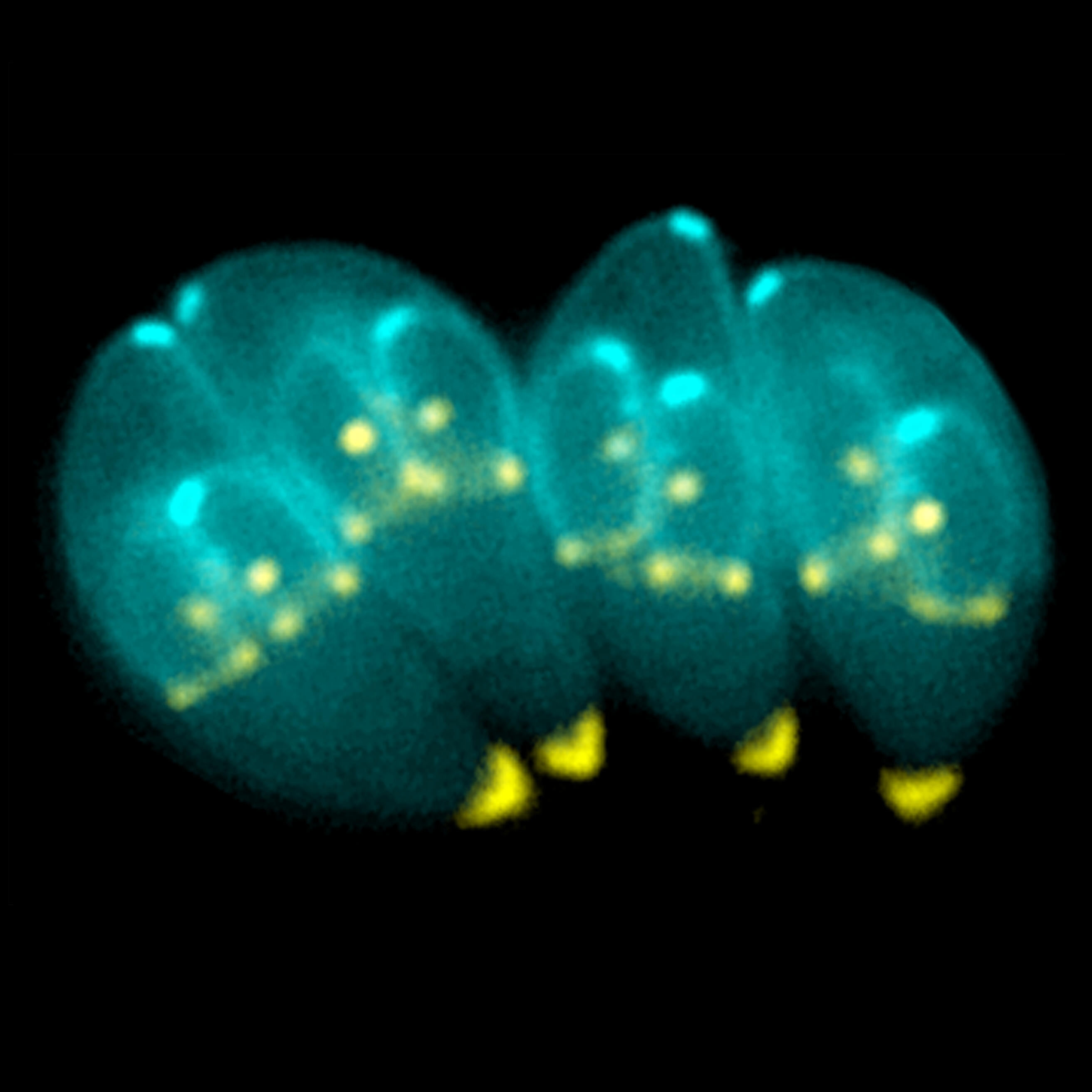 Toxoplasma gondii. Credit: Wikipedia