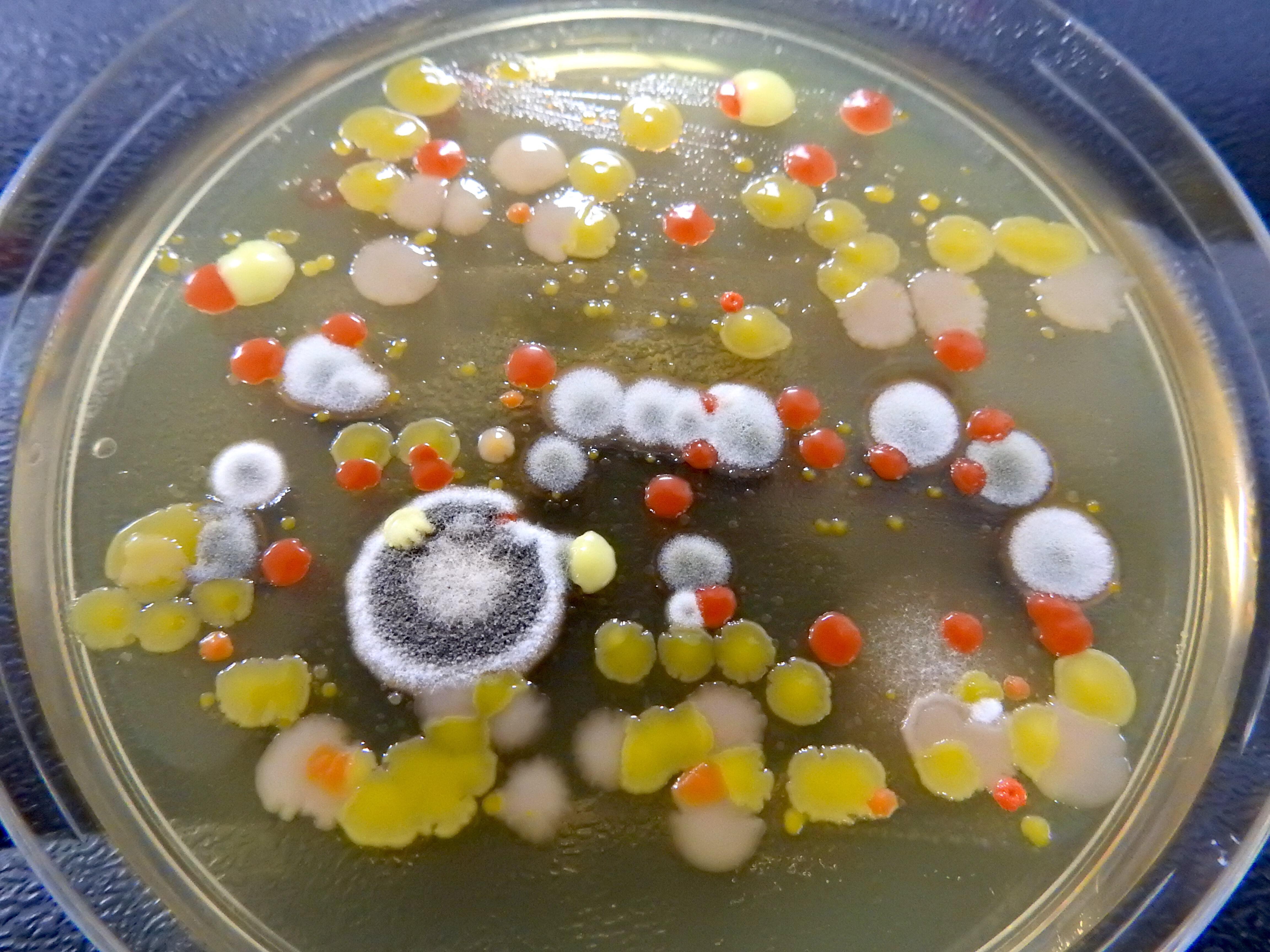A variety of different bacteria and fungi isolated as part of LSTM's Swab and Send project 