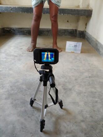 Camera set up for taking images of participants lower legs
