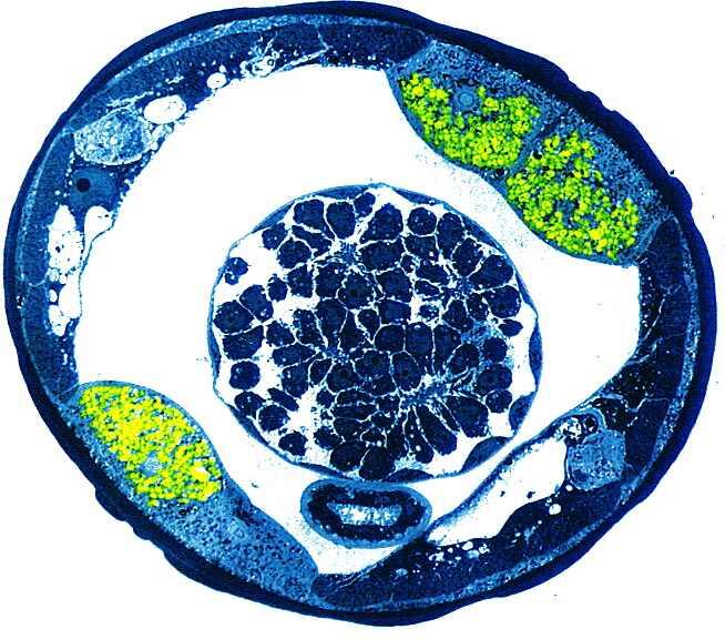 Cross section filarial nematode wolbachia in green Cross section filarial nematode wolbachia in green