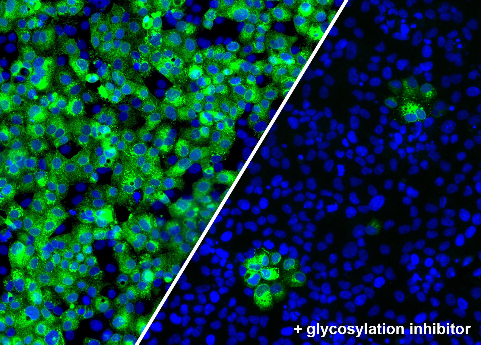 Human cells normally infected with SARS-CoV-2, here shown in green (left). Upon treatment with a sub-inhibitory dose of a glycosylation inhibitor, the infection is greatly reduced (right) Human cells normally infected with SARS-CoV-2, here shown in green (left). Upon treatment with a sub-inhibitory dose of a glycosylation inhibitor, the infection is greatly reduced (right)