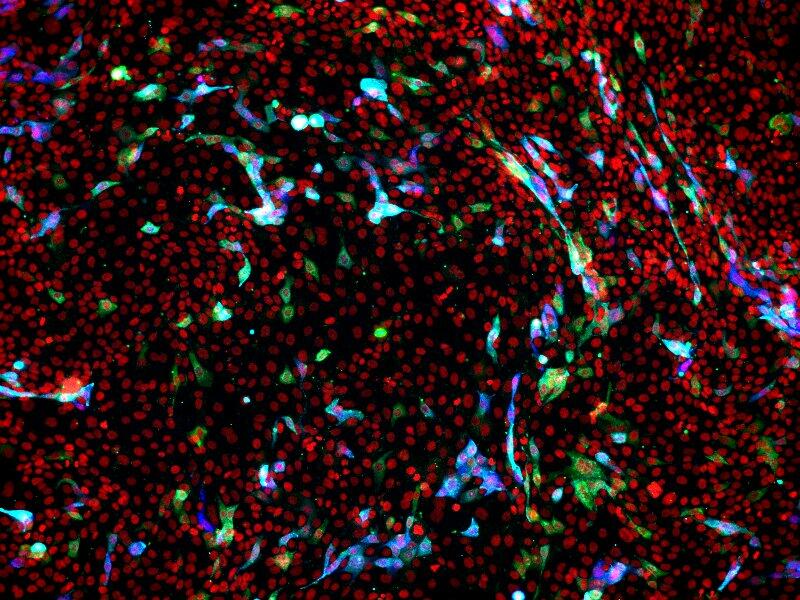 Infected lung epithelial cells