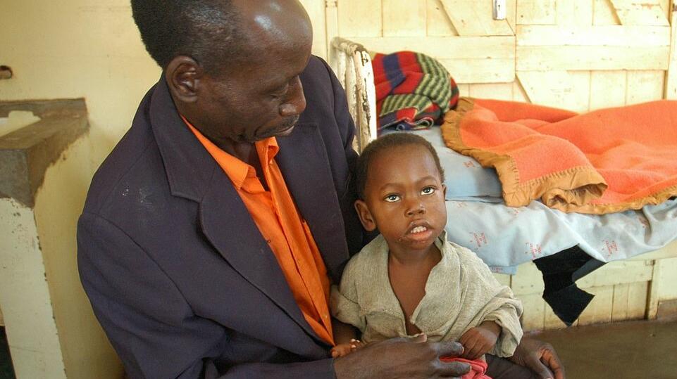 Credit: Jmesser5 via Wikimedia Commons. Child recovering from cerebral malaria