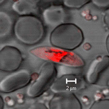 Plasmodium falciparum late-stage gametocyte, one of the parasite stages targeted by primaquine