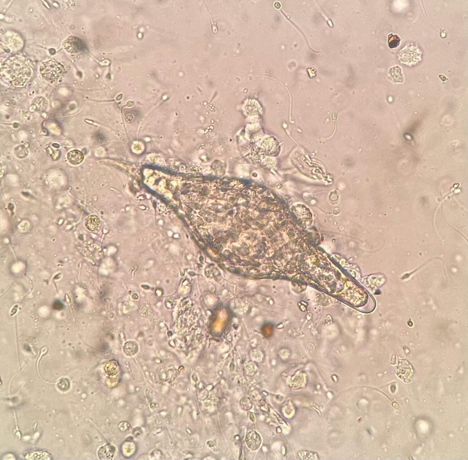 The egg of a hybrid schistosome, the subject of the new research