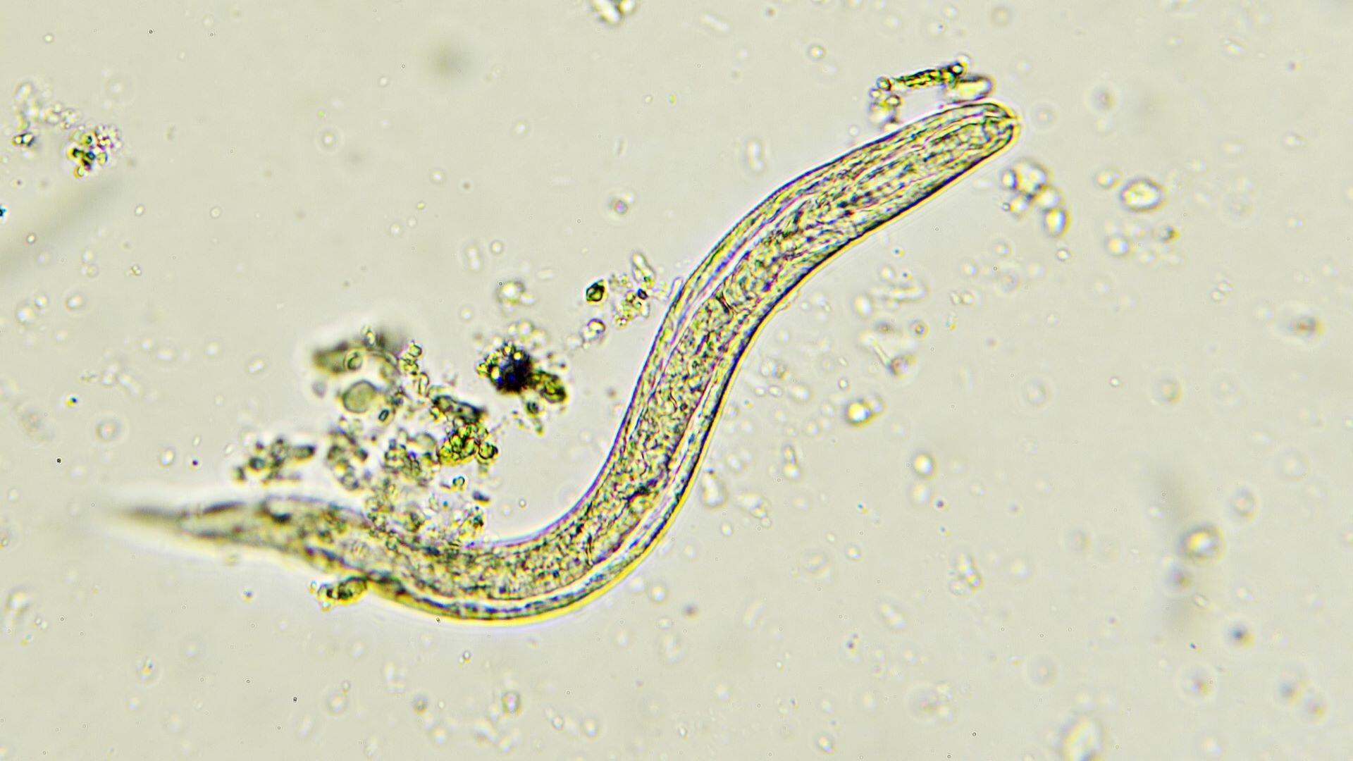 A Strongyloides stercoralis threadworm (image: iStock/jarun011)