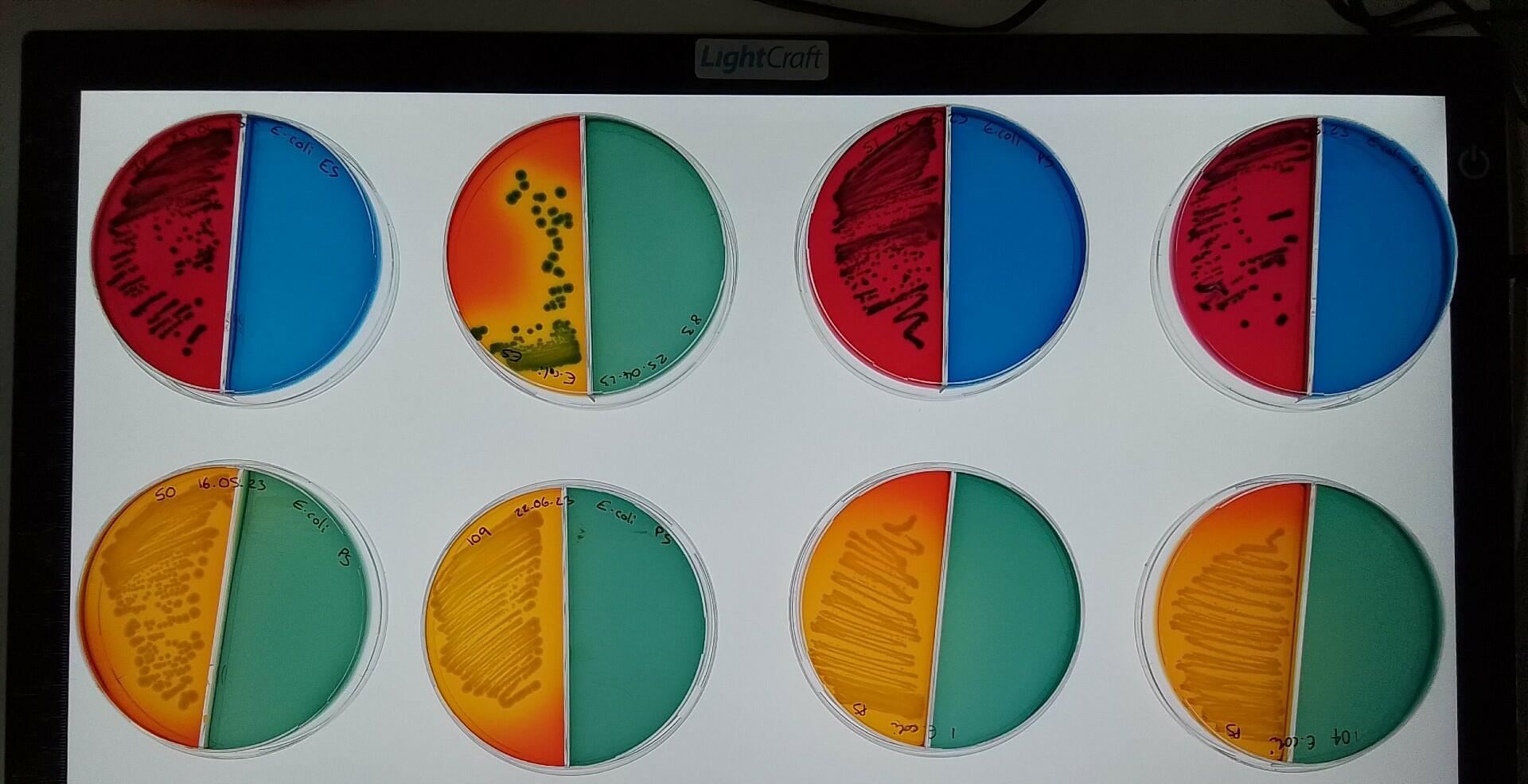 E.coli samples