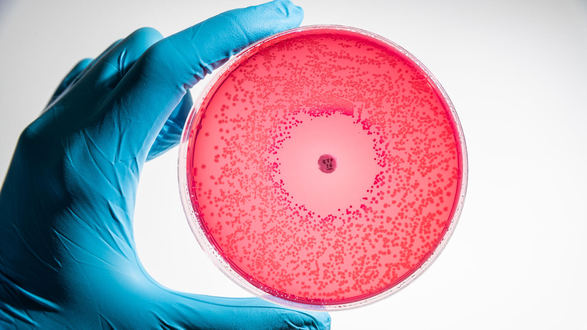 microbiological culture being examined