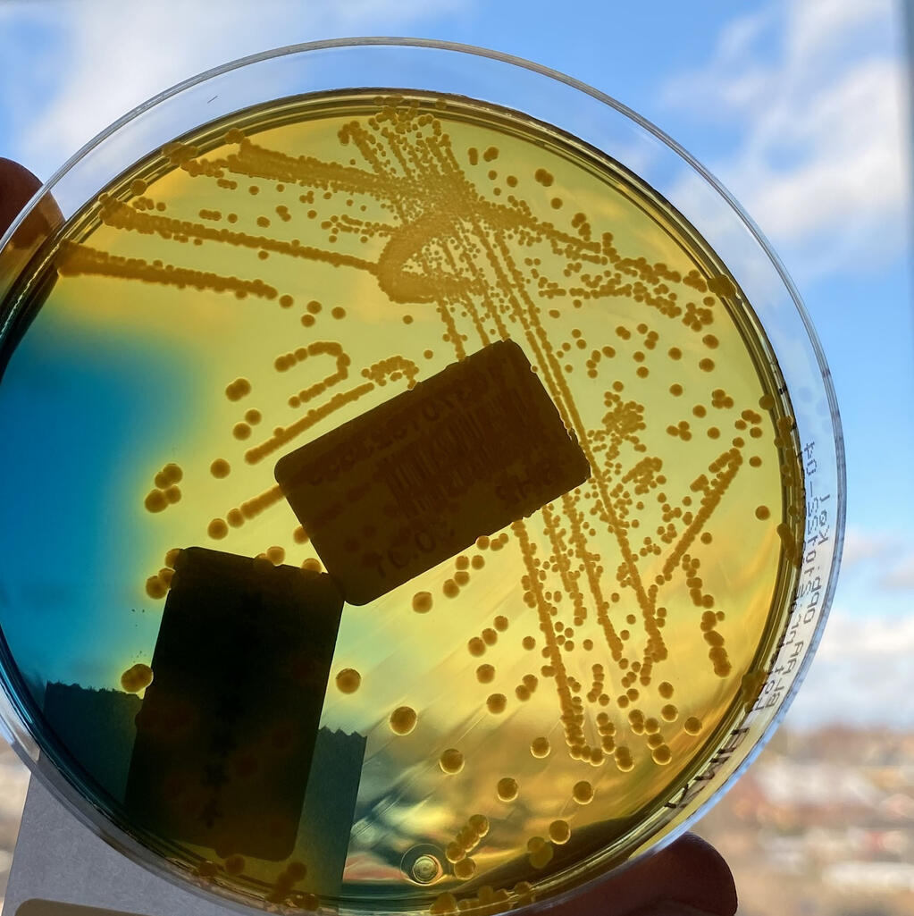 E.coli grown on an agar plate held against the sky