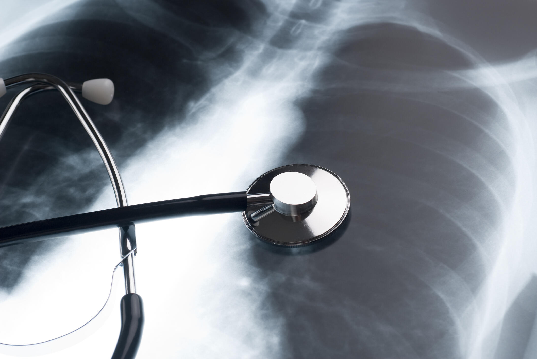 Image of a chest x ray