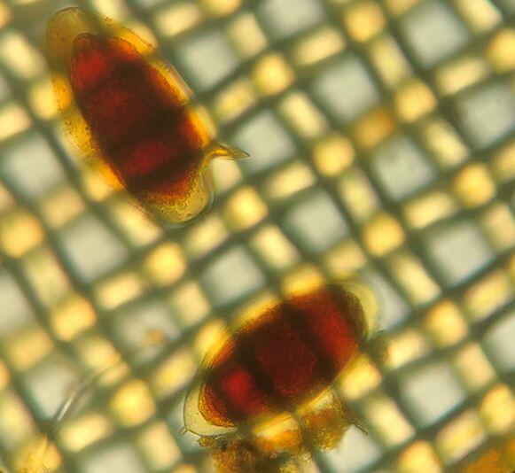 image of eggs of Schistosoma haematobium and S. mansoni in the urine of a Malawian male child. Image: Dr Seke Kayuni