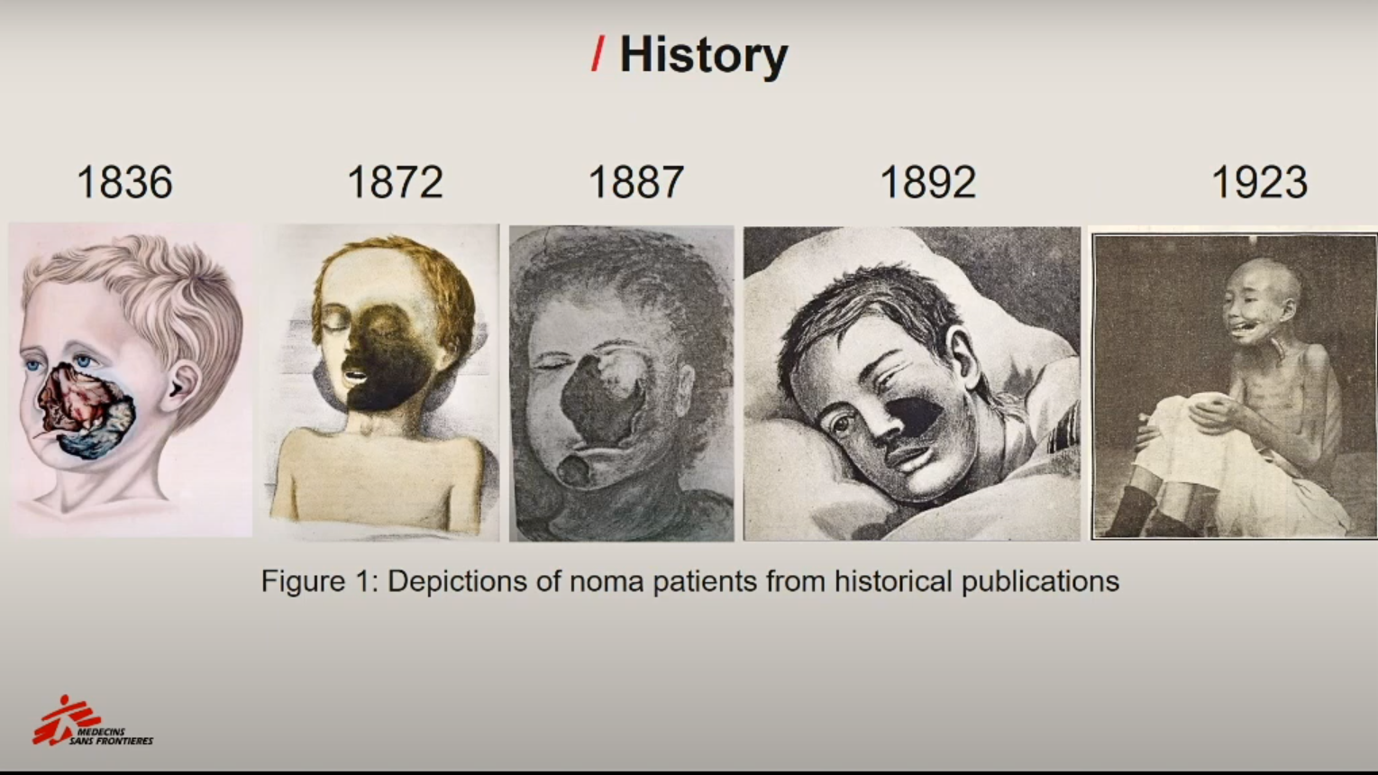 Historical illustrations of Noma