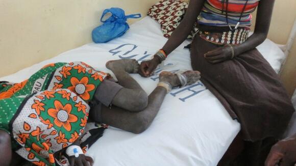 It took this mother 14 hours to get her child, who was bitten by a snake, to hospital in Baringo, Kenya to receive antivenom. The amount of time required for a snakebite victim to reach a medical centre to receive treatment remains a major issue in rural African communities. Photo taken by Prof. Rob Harrison.