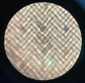 A view at x100 of an egg of Schistosoma mansoni