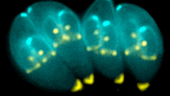 Toxoplasma gondii. Credit: Wikipedia