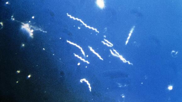 Borrelia burgdorferi - credit: CDC